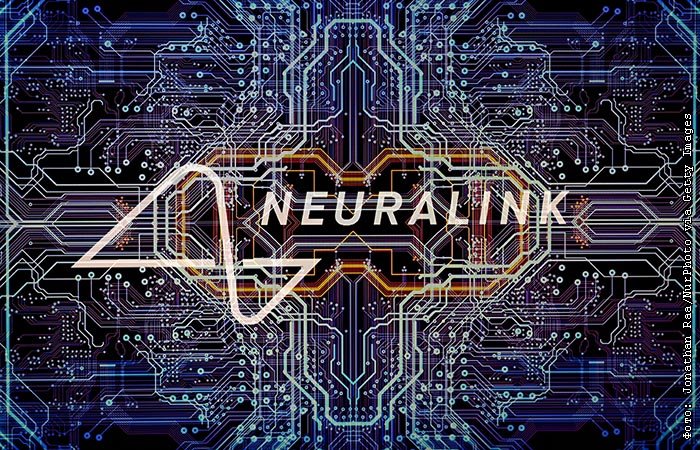 Пацієнт з імплантованим чипом Neuralink зіграв у Counter-Strike 2 силою думки