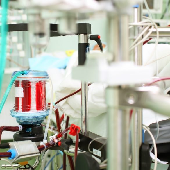 Fintech-компанія LeoGaming передала 2,8 млн грн на апарат «штучних легенів» для лікування ускладнень коронавіруса