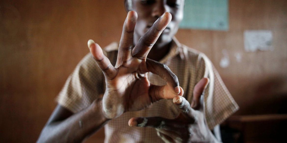 Американские ученые представили перчатку, которая помогает озвучивать язык жестов