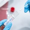 Корейские ученые изобрели биосенсор, выявляющий коронавирус быстрее ПЦР-анализа