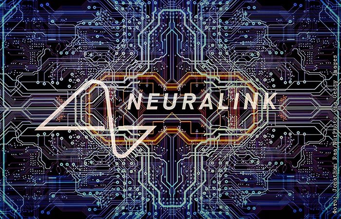 Перший пацієнт Neuralink розповів, як живе з нейрочипом у мозку