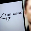 Neuralink Ілона Маска отримала дозвіл на вживлення чипа другому пацієнту